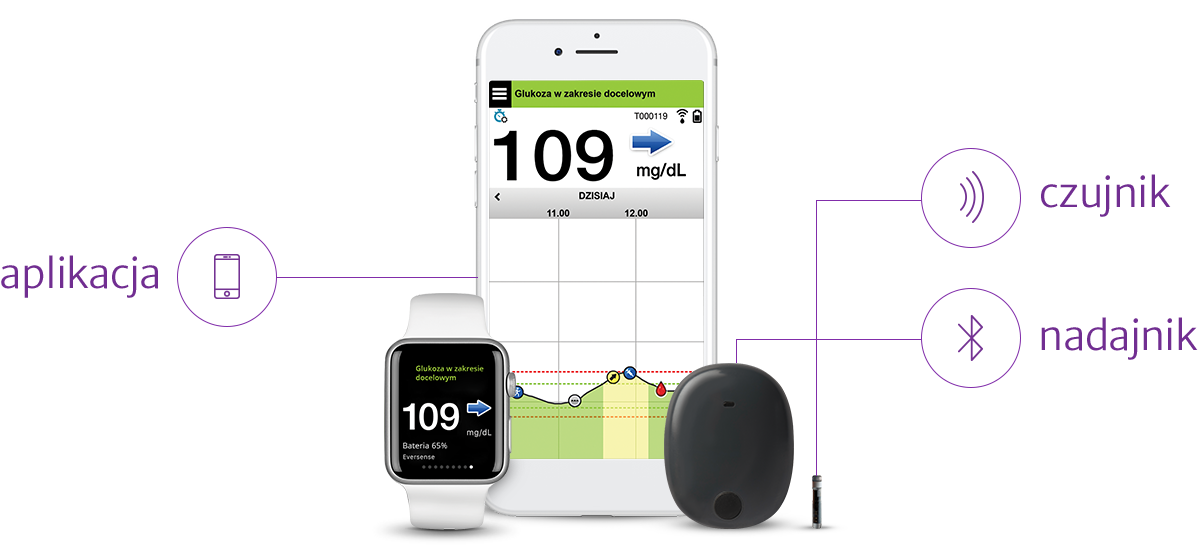 opis systemu CGM Eversense